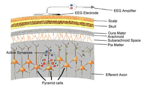 Qué es y qué podemos medir con el Electroencefalograma (EEG)