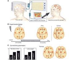 Cómo el Entrenamiento Cognitivo cambia nuestro cerebro