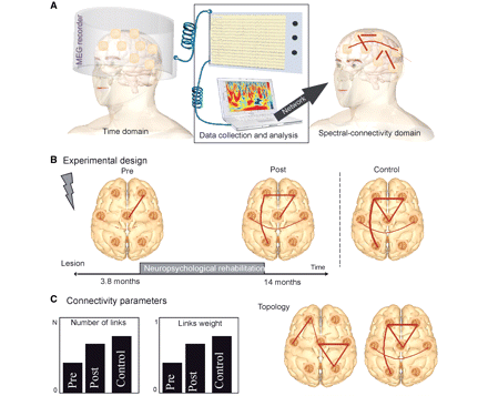 Cómo el Entrenamiento Cognitivo cambia nuestro cerebro