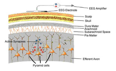 Qué es y qué podemos medir con el Electroencefalograma (EEG)